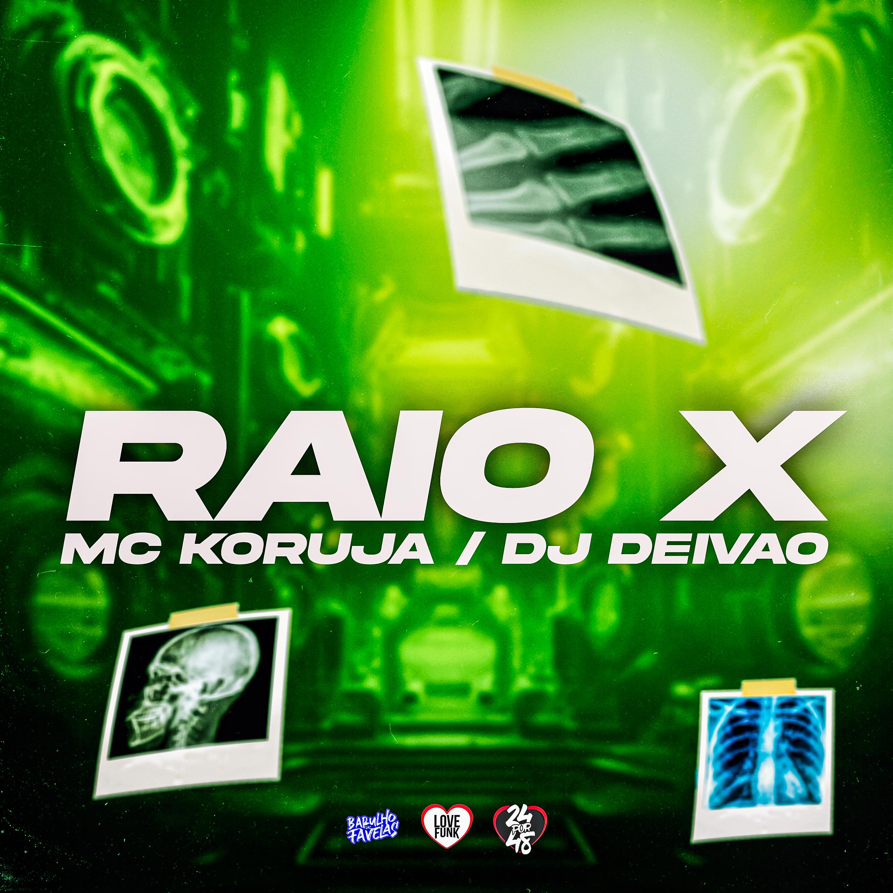 Постер альбома Raio X