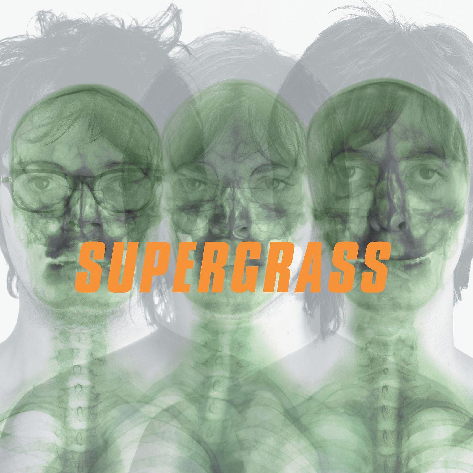 Постер альбома Supergrass