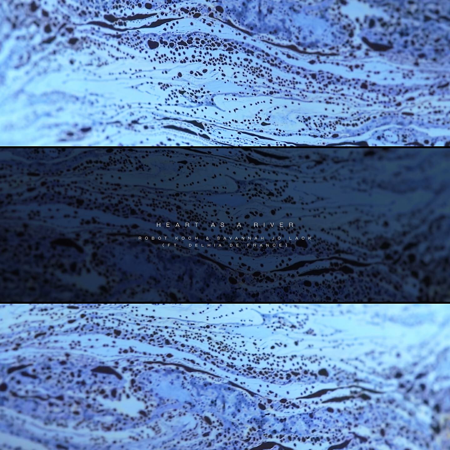 Robot Koch - Heart as a River