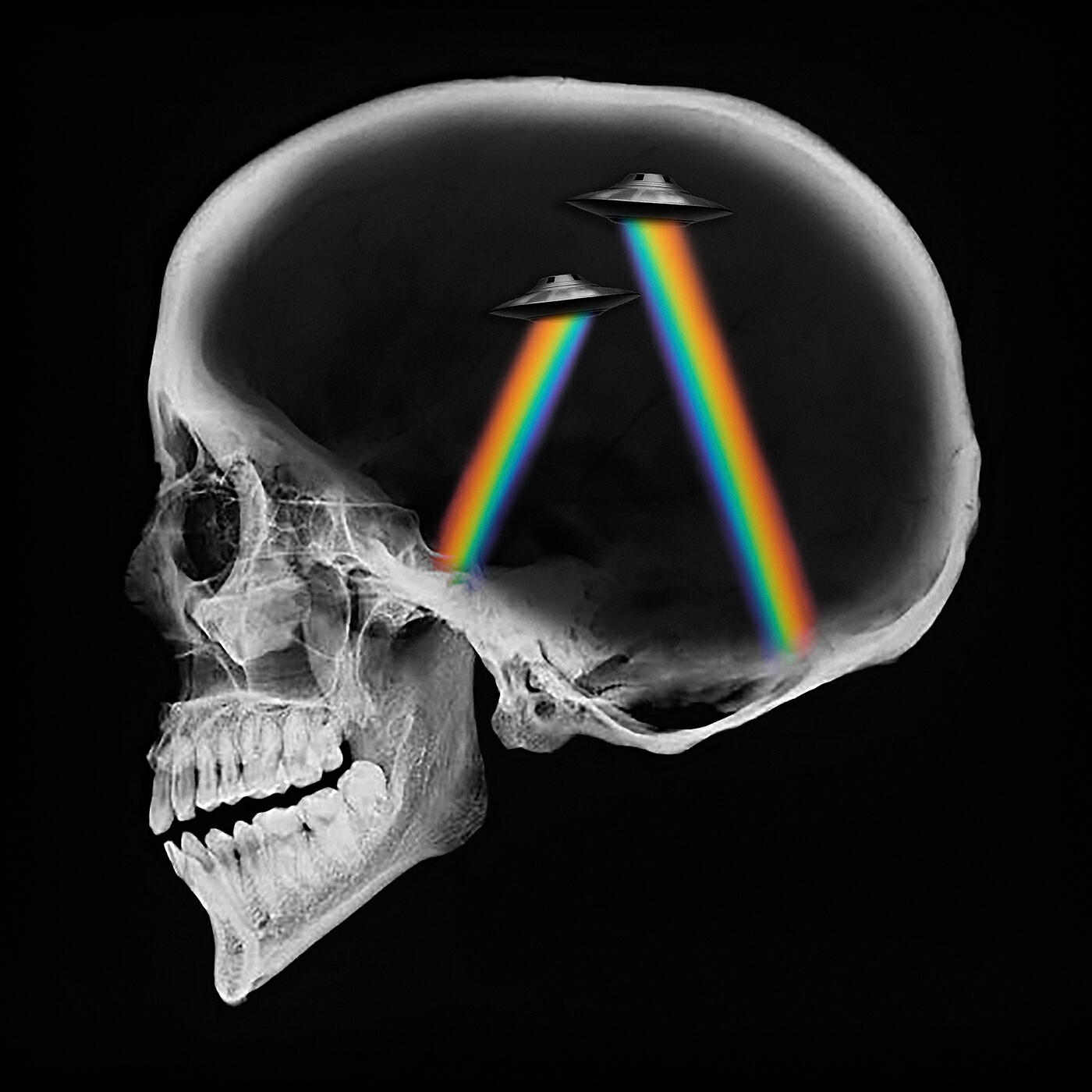 Axwell /\\ Ingrosso - Dreamer (Matisse & Sadko Remix)
