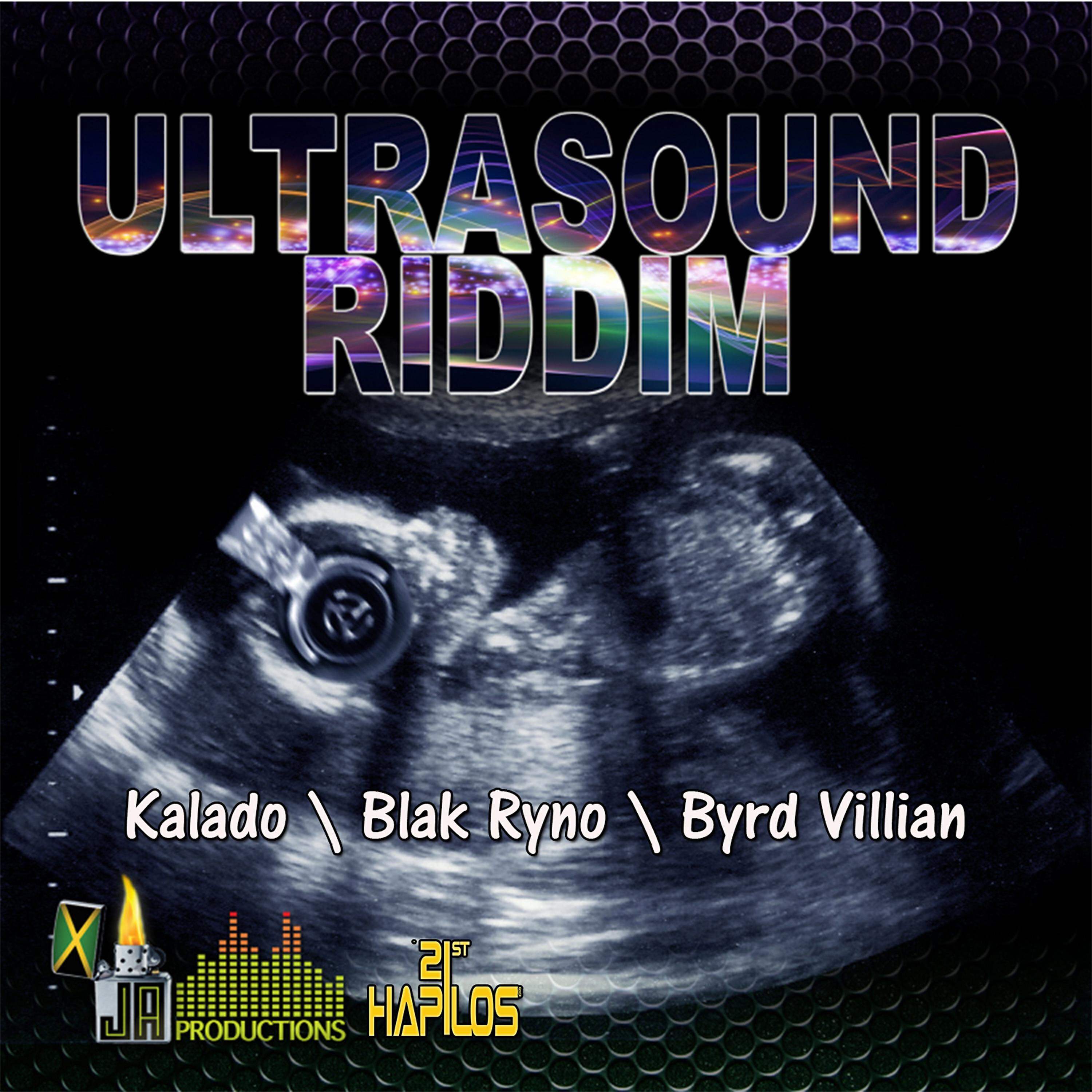 Blak Ryno - Way U Wine
