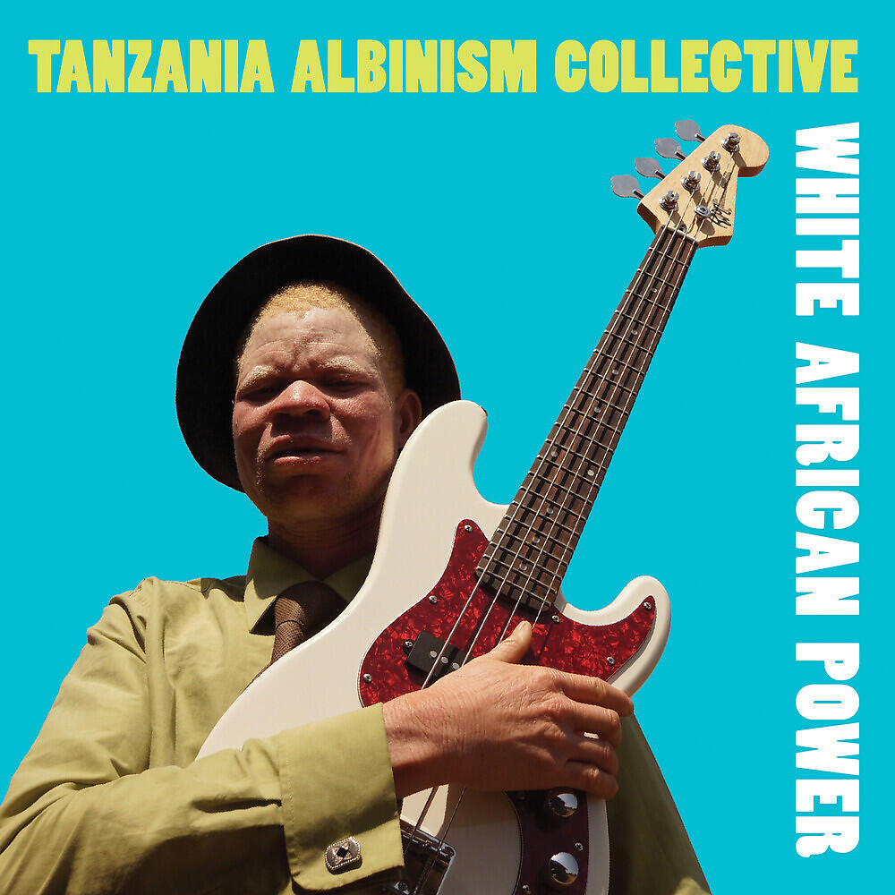 Tanzania Albinism Collective - Stigma, Everywhere