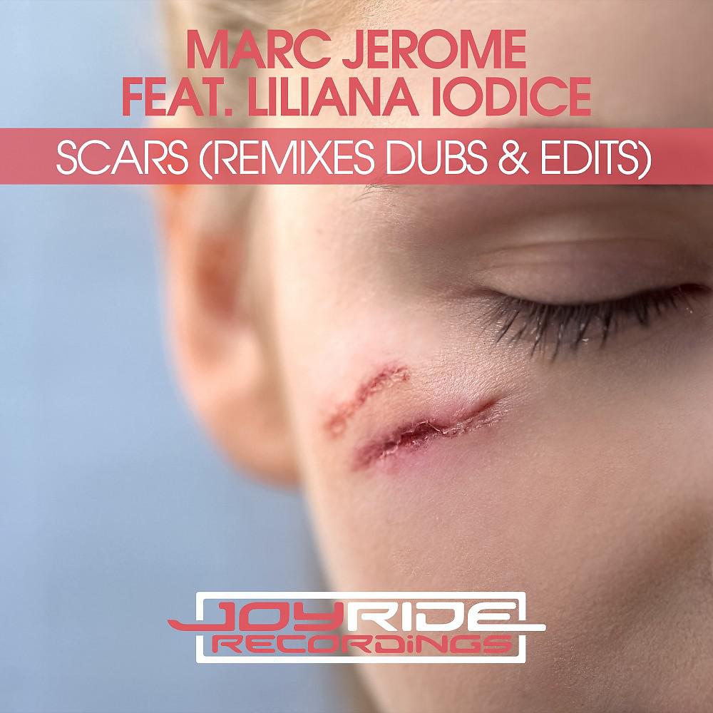 Постер альбома Scars (Remixes Dubs & Edits)