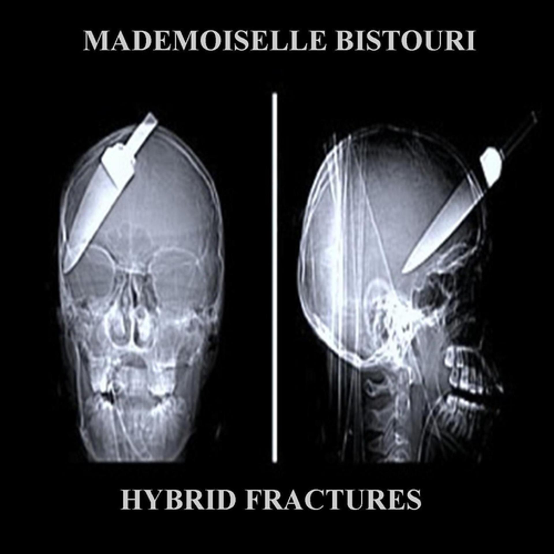 Постер альбома Hybrid Fractures
