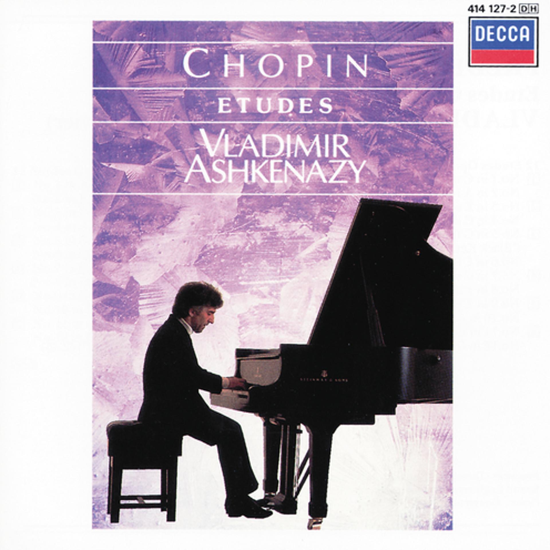 Постер альбома Chopin: Etudes
