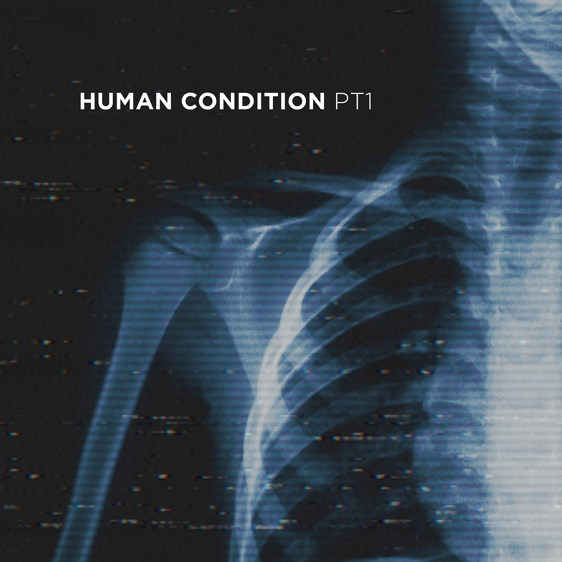 Постер альбома Human Condition - Pt. 1